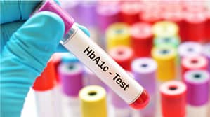 HbA1C test works