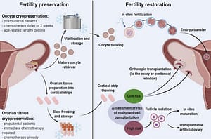 ovarian tissue cryopreservation