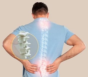 Dont-Risk-Your-Bones