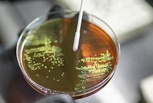 Bacteria