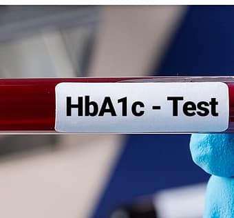 HbA1C