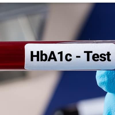 HbA1C