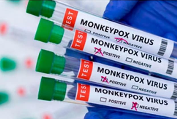 Monkeypox