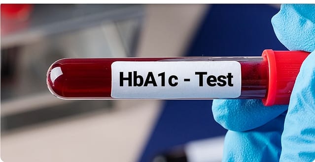 HbA1C
