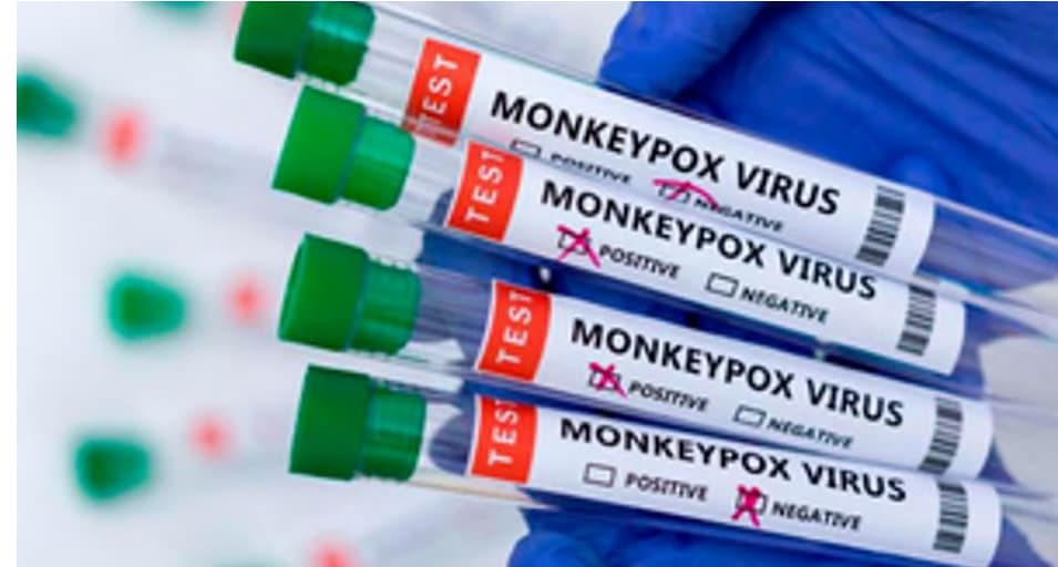 Monkeypox